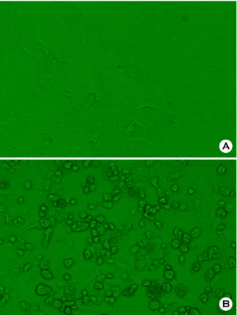 Figure 2. Immunofluorescent staining of AMPV (SC1509  strain)-infected Vero cells using AMPV-specific monoclonal  antibody 12.2.1
