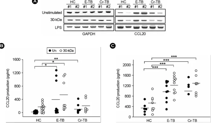 Figure 3 . CCL20 expressions in PBMCs and MDMs from healthy controls (HC) and TB patients (E-TB and Cr-TB) in response to  30-kDa Ag