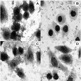 Figure 3. SDS-PAGE of  S-layer proteins of  W. cibaria strains  extracted by LiCl (5 mol l -1 ) treatment