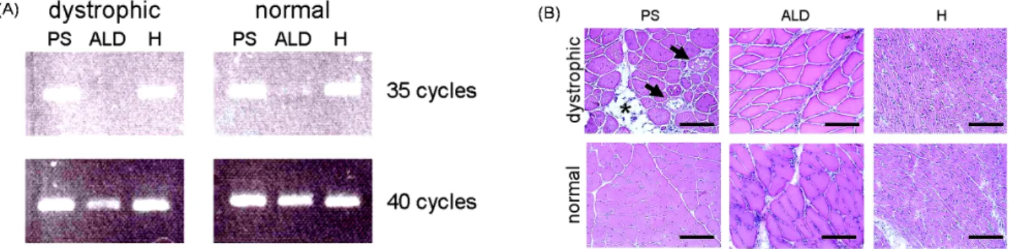 Fig.  5.  RT-PCR  detection  of  WWP1  gene  and  histological  analysis  for  three  representative  muscle  types