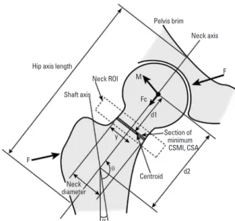 Fig. 1. Parameters of proximal hip geometry: Hip axis length (HAL): 
