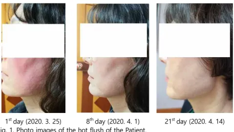 Fig. 2. Timeline analysis of this case. This figure’s category such as Therapeutic  intervention,  Timeline,  Disease  status,  Patient  adherence,  Outcome  and  Patient  perspective follow the CARE guideline