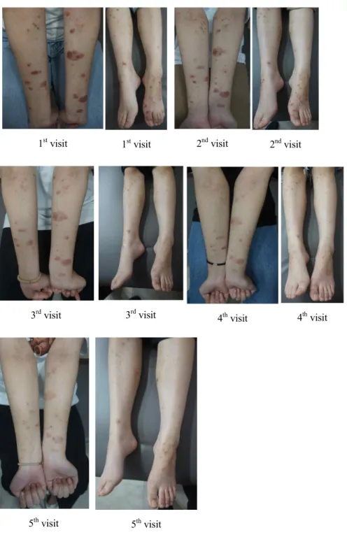 Figure 2. Therapeutic process of Case. 