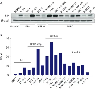 Figure 4. (A) Western blot analysis shows that NMI expression is reduced in some of the breast cancer cell lines