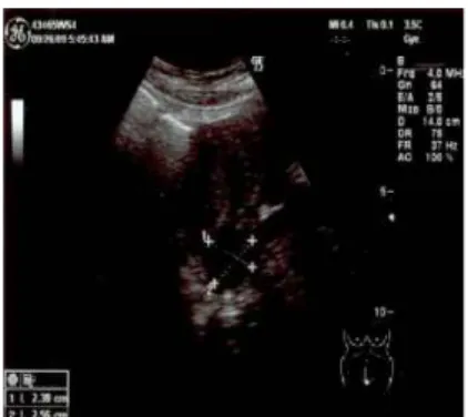 Fig. 2. Gynecologic U.S.G. image (09.26) Fig. 3. Gynecologic U.S.G. image (10.10)