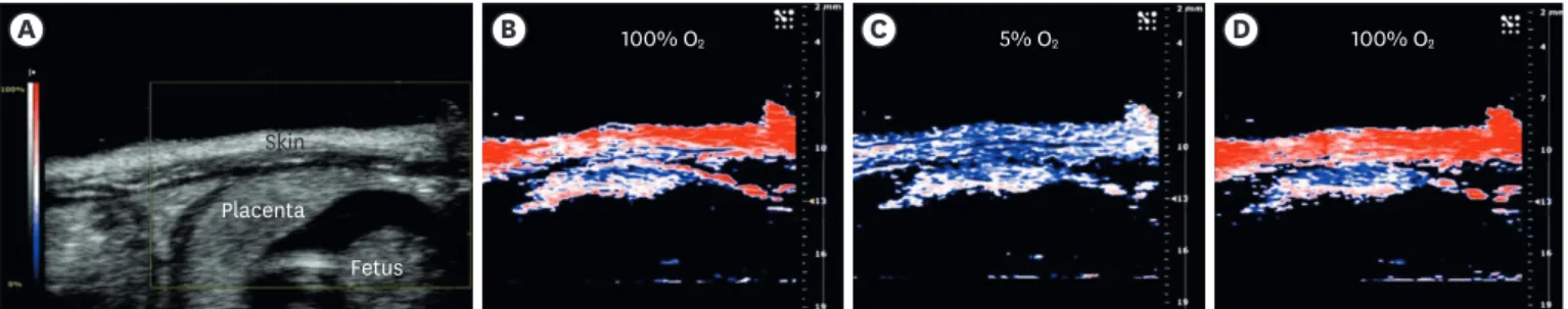 Figure 2. PA imaging of placental oxygenation on day 14 of gestation. (A) The placenta in a sagittal plane (obtained by a B-mode ultrasound scan) and parametric  images created with the PA oxyhemo mode making possible the evaluation of blood oxygen saturat