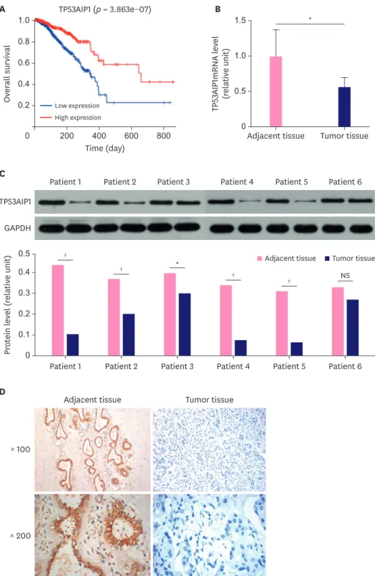 Figure 1. TP53AIP1 is down-regulated in patients with breast cancer. (A) Data from The Cancer Genome Atlas database were collected, and the data showed that  breast cancer patients with low level of TP53AIP1 had lower survival rates