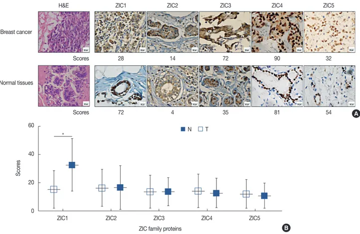 Figure 1. ZIC member expression in invasive breast cancer. (A) Hematoxylin and eosin (H&amp;E) and immunohistochemical staining of zinc finger of the  cerebellum (ZIC) family proteins in breast tumors and corresponding normal tissues