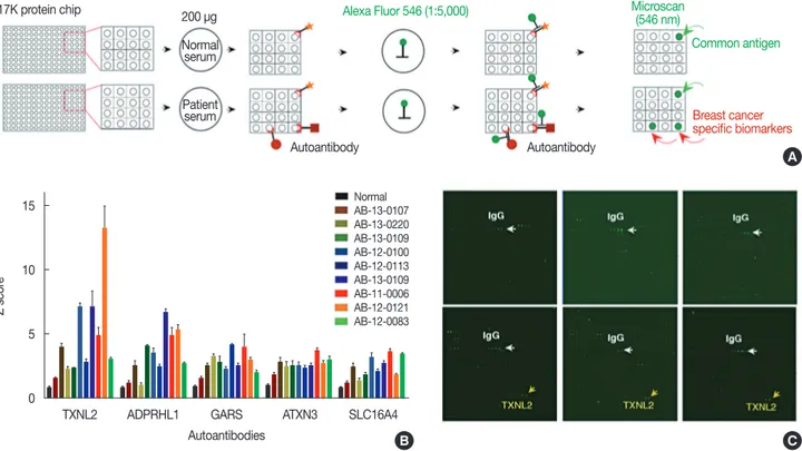 Figure 1. Identification of five autoantibodies for triple-negative breast cancer (TNBC) biomarkers  using a 17K human protein microarray system