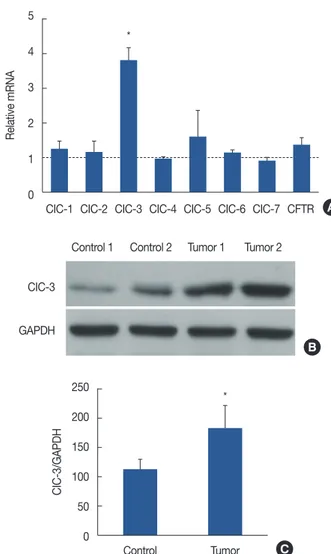 Figure 1. Chloride channel-3 (CIC-3) expression in breast tumor tis- tis-sues. (A) Chloride channels (ClC-1−7, CFTR) are expressed in human  breast cancer tissues from clinical postoperative patients, as indicated  by qRT-PCR mRNA analysis