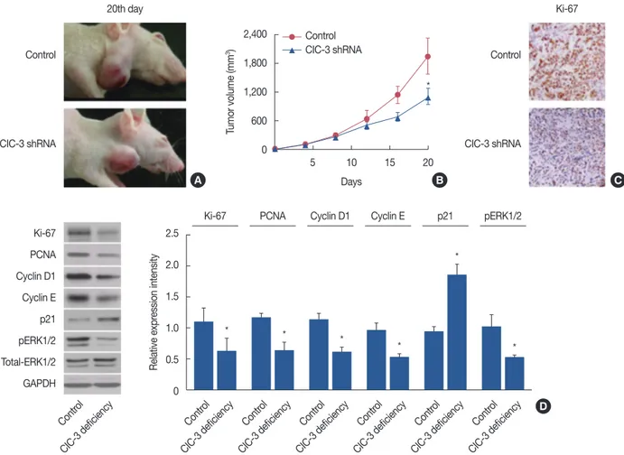 Figure 6. Effects of chloride channel-3 (ClC-3) knockdown on the growth of human breast tumors in vivo
