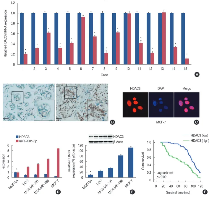 Figure 1. Histone deacetylases-3 (HDAC3) expression in breast cancer. (A) Real-time reverse transcription polymerase chain reaction (RT-PCR) was  performed to analyze of messenger RNA (mRNA) expression of HDAC3 in breast cancer tissue of 15 fresh specimens