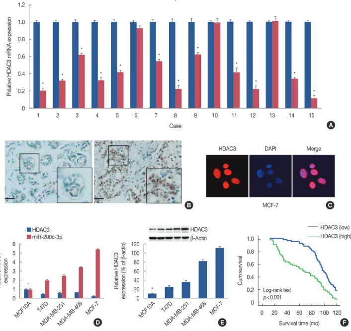 Figure 1. Histone deacetylases-3 (HDAC3) expression in breast cancer. (A) Real-time reverse transcription polymerase chain reaction (RT-PCR) was  performed to analyze of messenger RNA (mRNA) expression of HDAC3 in breast cancer tissue of 15 fresh specimens