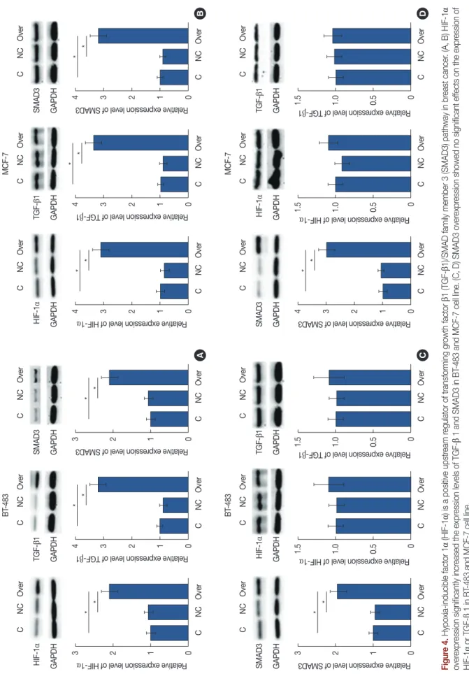 Figure 4. Hypoxia-inducible factor 1α (HIF-1α) is a positive upstream regulator of transforming growth factor β1 (TGF-β1)/SMAD family member 3 (SMAD3) pathway in breast cancer