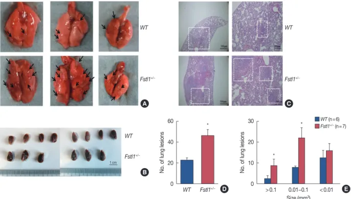 Figure 4. Increased lung metastasis in Fstl1 +/−  mice. (A) Thirty-one days after injection of 4T1 cancer cells, the mice were euthanized and analyzed for  lung metastasis