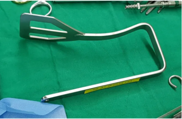 Figure 1. Patient position. (A) A picture of patient position. (B) A sche- sche-matic illustration of patient position