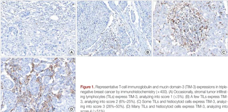 Figure 1. Representative T-cell immunoglobulin and mucin domain-3 (TIM-3) expressions in triple- triple-negative breast cancer by immunohistochemistry (×400)