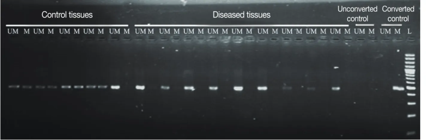 Figure 1. Agarose gel (2%) showing promoter methylation pattern of E2F5 gene in tumors and control tissues of breast cancer