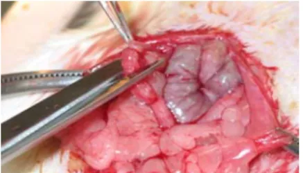 Fig.  1.  Find  out  Right  Uterine  Horns  and  Binding  Both  Sides  for  the  Prevention  of  Excessive  Bleeding