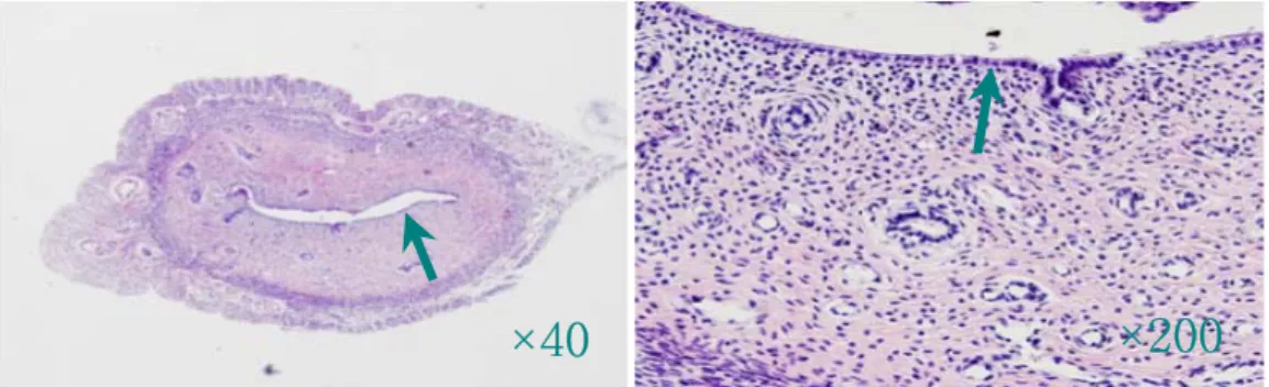 Fig.  5.  Histological  Observation  of  Normal  Endometrium  Tissue  by  H-E  stain Arrows  :  The  dark  violet  coloring  part  is  normal  endometrium  tissue.