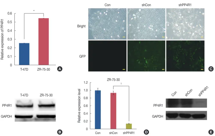 Figure 1. Establishment of protein phosphatase 4 regulatory subunit 1 (PP4R1)-silenced breast cancer cells