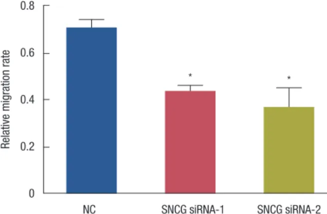 Figure 2. The relative migration rate of each group. The relative migra- migra-tion rate of Synuclein- γ (SNCG) siRNA-1 and SNCG siRNA-2 groups  decreased significantly (p<0.05, respectively).