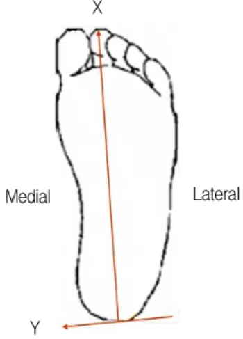 Figure 1.  Length, width and slope height of wedged insoles in the  experiment