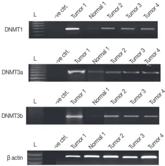 Figure 1. Expression levels of DNMT1, DNMT 3a, and DNMT3b in breast  cancer tissues. The levels of DNMT1, DNMT3a, and DNMT3b mRNA  were observed to be 1.2- to 4.4-folds, 1.1- to 3.77-folds, and 1.06- to  4.01-folds elevated in most of the breast cancer tis