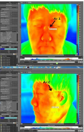 Fig.  2.  A  representative  thermal  image  result  of  a  subject  after  taking  off  glasses