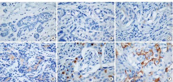 Figure 1. CD133 immunostaining. (A) Immunonegativity for CD133 in normal breast cells (×60)