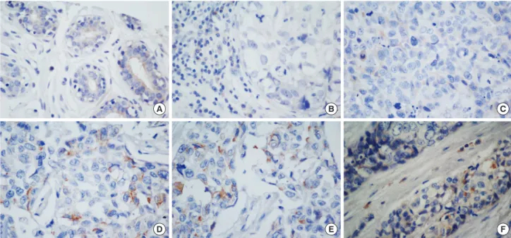 Figure 2. Geminin immunostaining. (A) Geminin low cytoplasmatic expression in normal breast cells (×60)