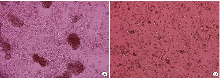 Figure 2. CD44 + /CD24 -  cells were observed to form mammospheres one week after being cultured in serum-free medium (A:  ×20), while control  cells did not (B: ×20).