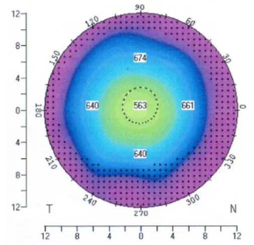 Table  1.  The  age  and  sex  distribution    of  the  cornea  test  in  Korean  young  population.