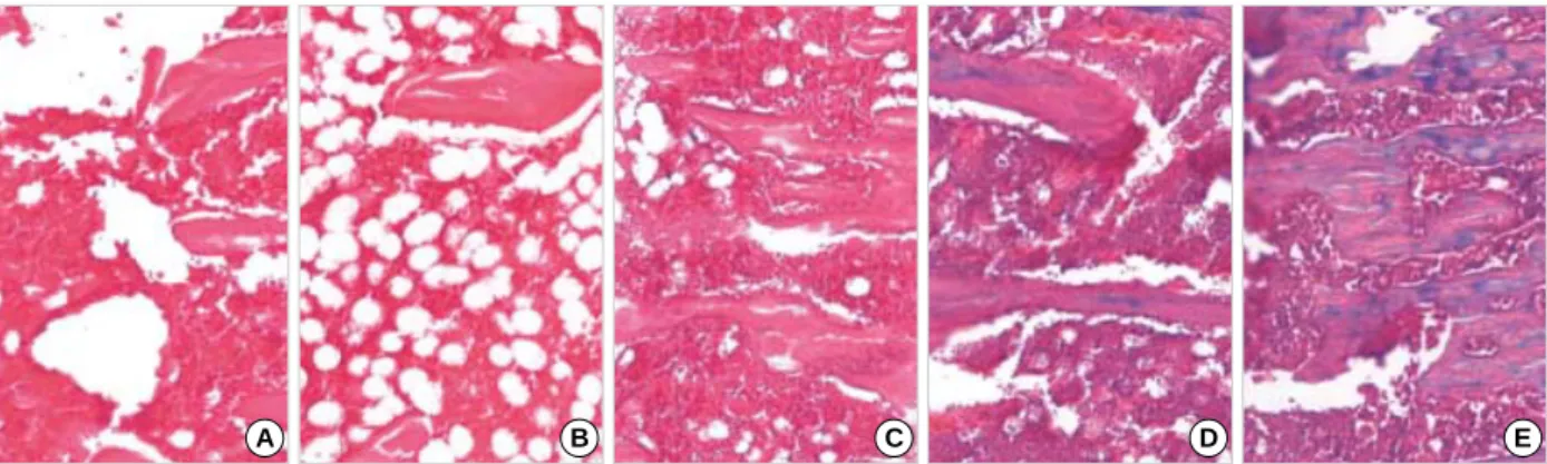Fig 5. The distinct pathologic findings of proximal tibia in each group: OC (A), OS (B), OZ (C), OL (D) and OZL (E) at 16 weeks after operation (H&amp;E stain, ×100)