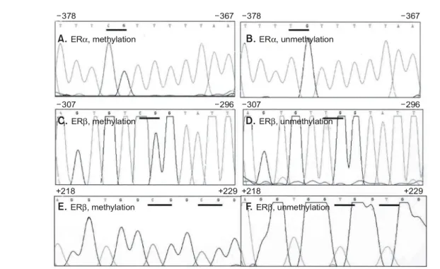 Fig.  3.  The  methylation  profiles  of  ERβ  gene  in  the  cancer  (No  44,  Table  1,  A)  and  the  adjacent  normal  tissue  (B)