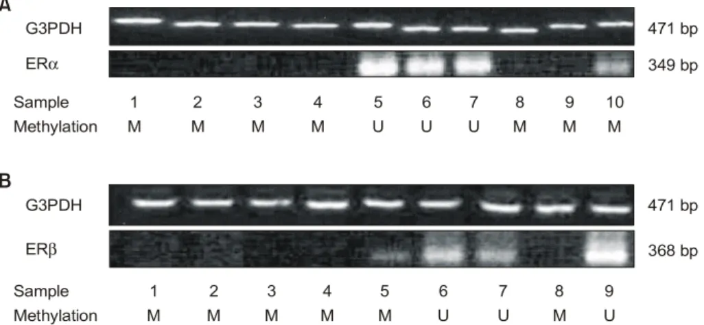 Table  2.  The  correlation  of  methylation  and  transcriptional  expression  in  ERα  and  ERβ  gene