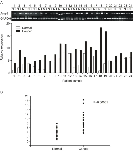 Fig.  1.  The  Ang-2  gene  expression  in  human  breast  carcinoma.  (A)  Expression  of  the  Ang-2  and  G3APDHin  22  patients  with  invasive  ductal  breast  cancer,  determined  by  RT-PCR
