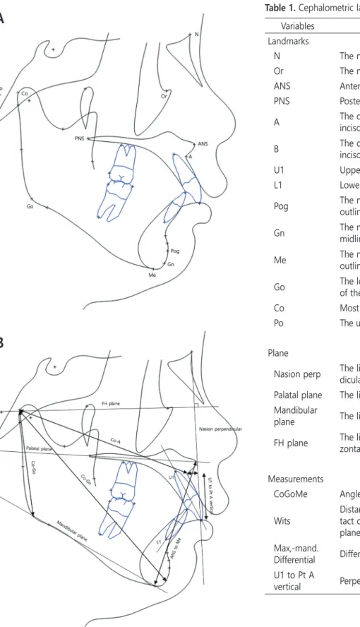 Table 1. Cephalometric landmarks and measurements Variables Definition Landmarks