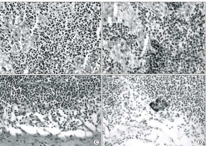 Table  5.  Calculated  efficacy  parameters  and  corresponding  95%  CI  for  the  rapid  immunostaining  of  SLN