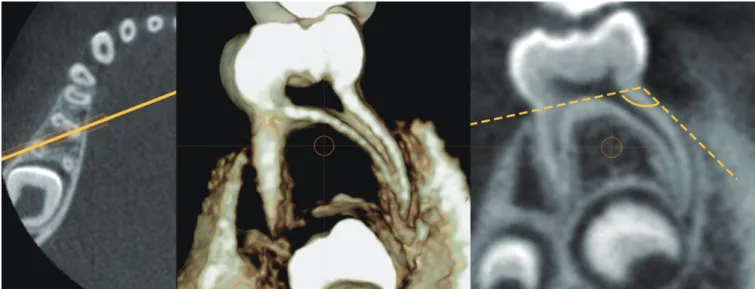 Fig. 5. Shape of the root and root canal. (A) Curved (B) straight (C) S-shaped