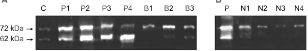 Fig.  1.  Zymograms  of  fibroadenomas,  breast  cancers  and  lymph  nodes.  (A)  C  =  Control  from  pro-MMP-2  c-DNA  transfected  MDA-MB-321  cell  line;  P1-P2  =  Primary  tumors  of  breast  cancer  without  node  metastasis;  P3-P4 