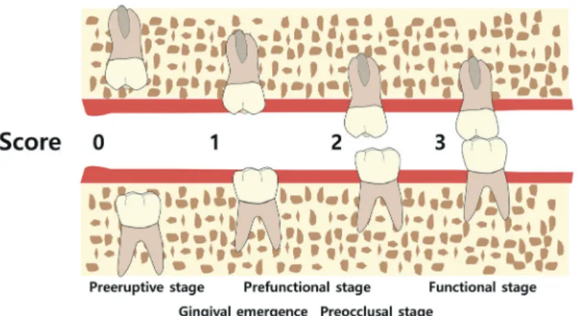 Fig. 2. Schematic image of tooth eruption stages.