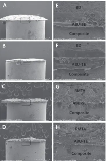 Fig. 5. Scanning electron microscope images of fractured  cross section of Biodentine