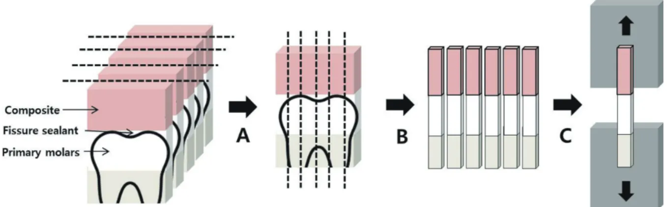 Fig. 1. Schematic diagram of preparation for microtensile bond testing. (A) Fissure sealants were restored on occlusal surface  of primary molars and sectioned into buccal-lingual parallel slices 1 mm thick, (B) New sections 1 mm thick were performed  in e