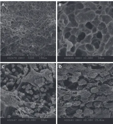 Fig. 2. Scanning electron microscope images of pathologic  root resorption surface of maxillary primary central incisors  resulting from trauma