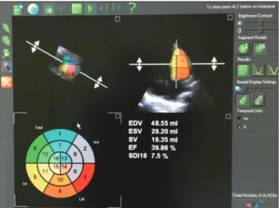 Fig. 1. Measurements of 3-dimensional left ventricular volumes using  3000 element matrix probe (3V probe) and analyzing the images of the  ventricle using Tom Tec 4D Cardio-View RT 1.2 software