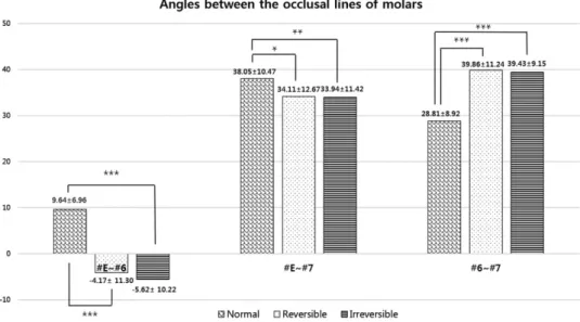 Figure 4 shows the angles between the occlusal lines in the molars. The ectopic eruption group showed a (-) angle between the primary second molar and the FPM.