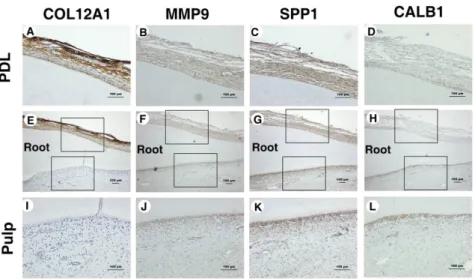 Fig. 3. Immunohistochemical staining of PDL and pulp samples (A-L). IHC staining for COL12A1 in (A,E) PDL and (E,I) pulp; for MMP9 in (B,F) PDL and (F,J) pulp; for SPP1 in (C,G) PDL and (G,K) pulp; and for CALB1 in (D,H) PDL and (H,L) pulp