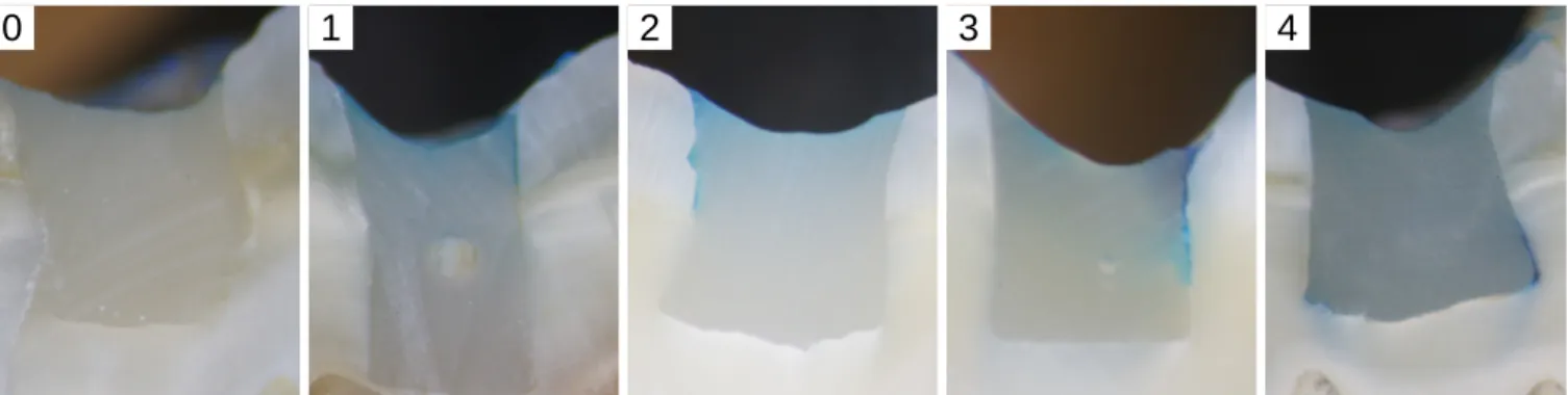 Fig. 2. Pictures of sectioned specimens for the rating of the methylene blue penetration (×19.2).