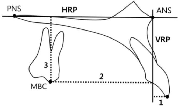 Fig. 2. The cephalometric landmarks and measurements. Maxillary length and mandibular length indicate Co-A and Co-Gn, respectively.